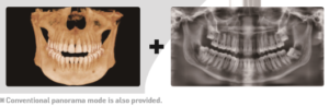 CBCT 2 in 1 image