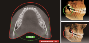 cone beam CT cbct image