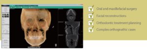 cone beam ct