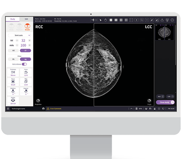 Mammography HESTIA