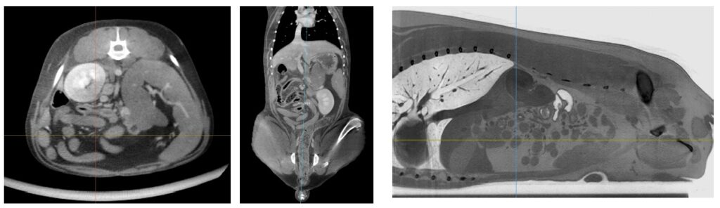 V-CT-Clinical-Images-1024x296