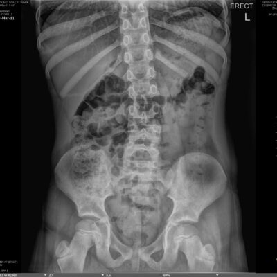 XRay example XRay example